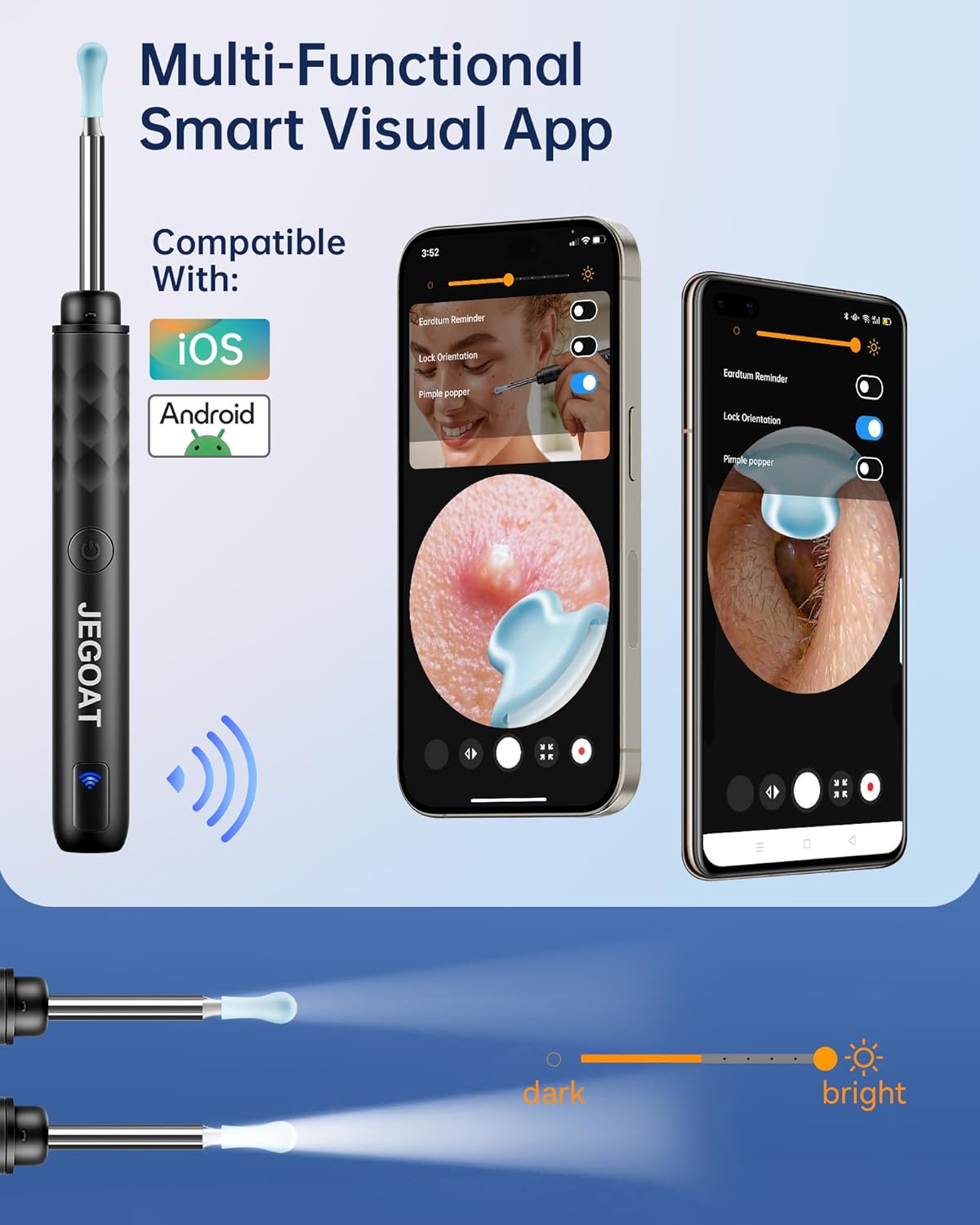 1296P HD Ear Wax Removal Camera Kit With 6 LED Lights